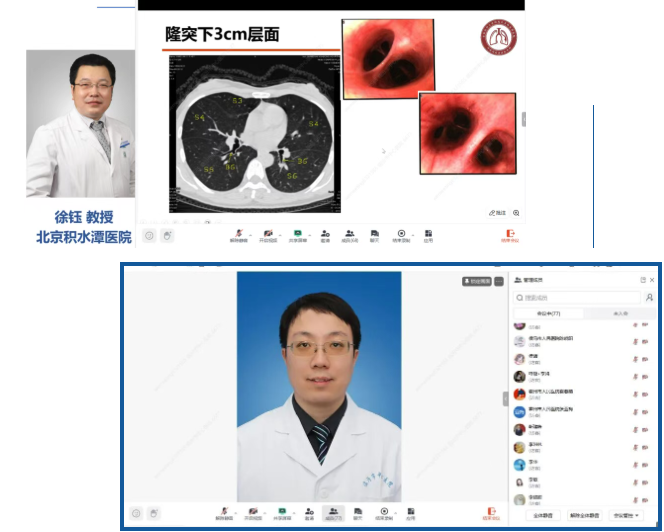临汾市中心医院承办山西省卫健委适宜技术基层推广项目—支气管镜检查线上培训